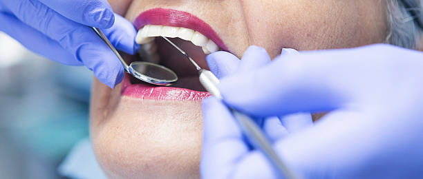 Best Emergency Treatment for Oral Infections in San Diego, CA